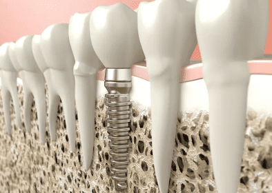 dental emergency burke va