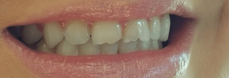 Before