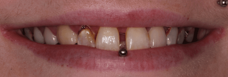 Before