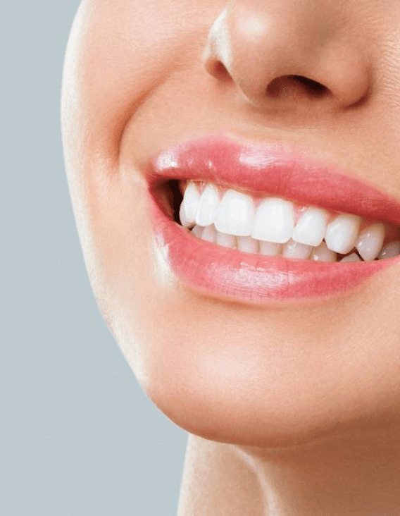 smile makeover in burke va