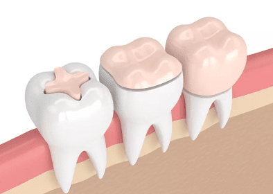 dental emergency burke va
