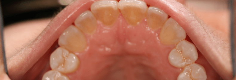 After