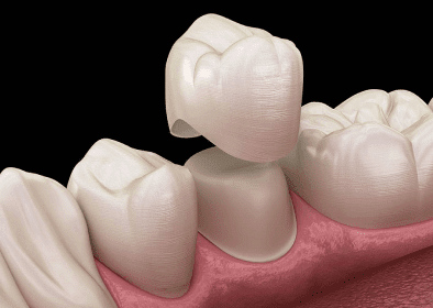 dental emergency burke va