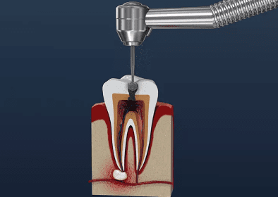 dental emergency burke va