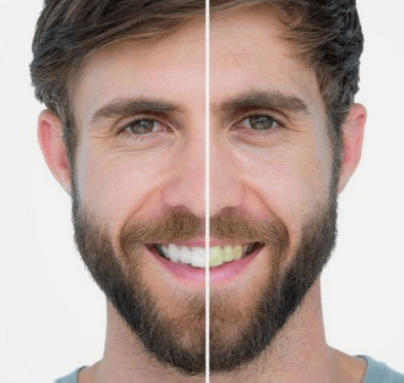 best cosmetic dentist in burke va