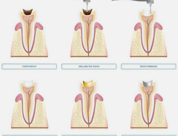 dental care burke va