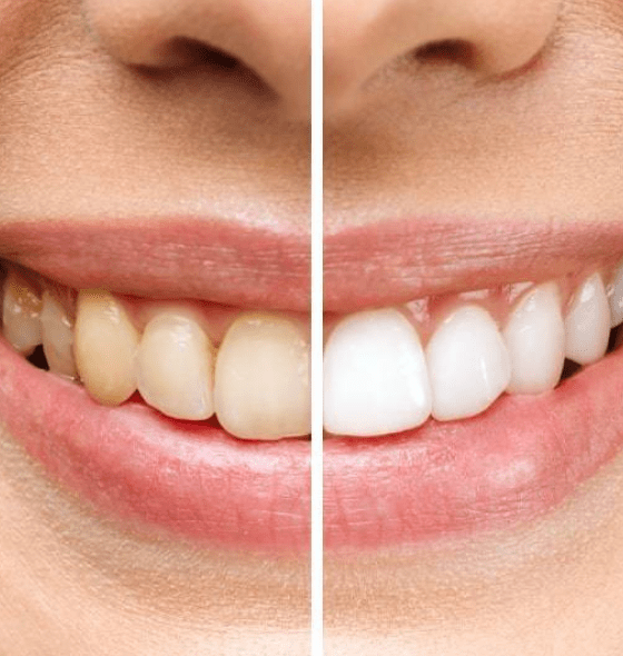 best cosmetic dentist in burke va