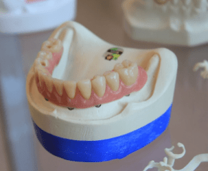 tooth repair burke va