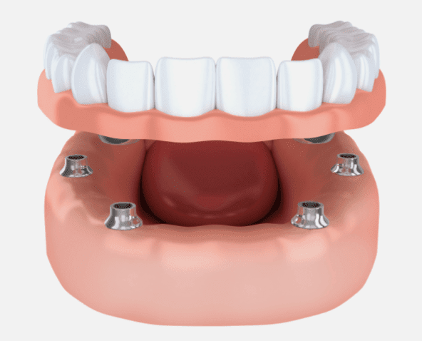 tooth repair burke va