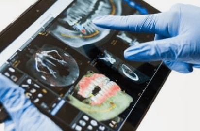 tooth repair burke va