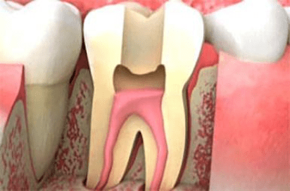 tooth repair burke va