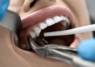 dental emergency burke va