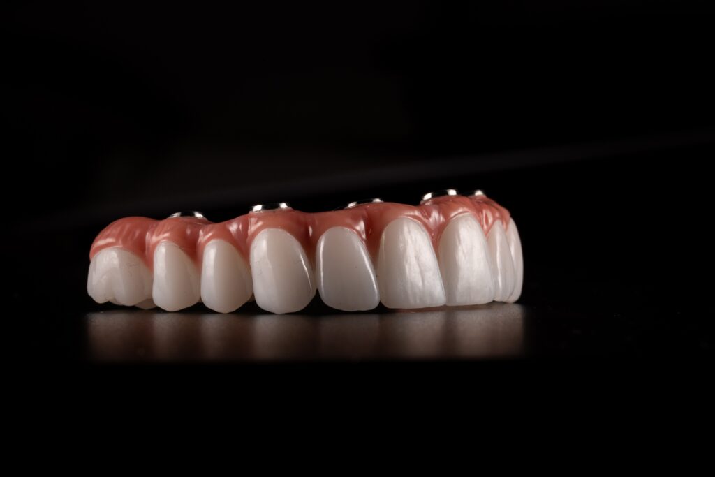 all on four dental implants