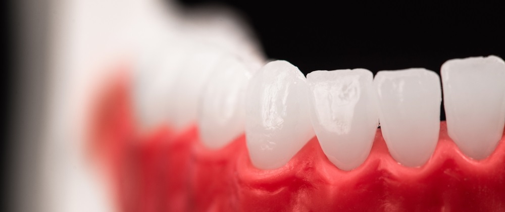 periodental maintenance
