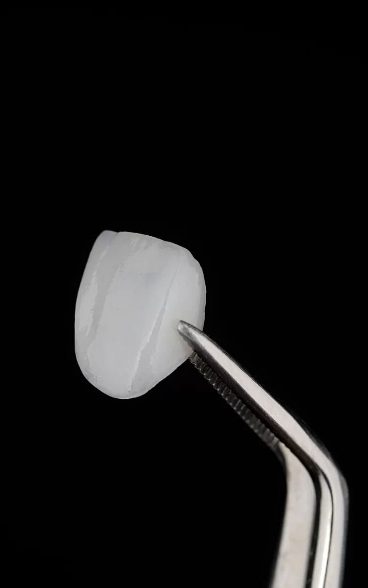 Combining Veneers, Implants, and Bridges for a Full Dental Restoration